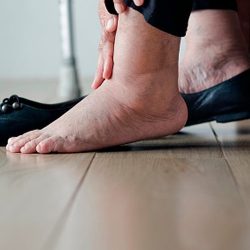 inflammation-douleur